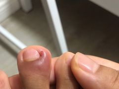 -郑远元专业修脚房(丹凤街店)