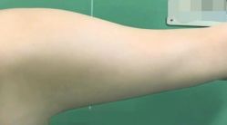 -东莞西妃整形美容医院