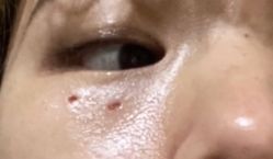 -美莱医学美容医院