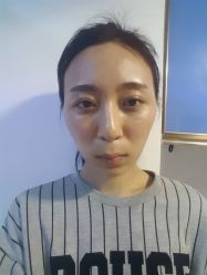 点击看大图 体验前-鑫元辰医疗美容整形