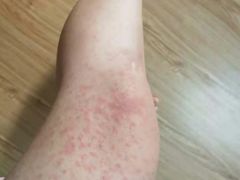 -龙达温泉生态城