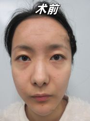 -素美医疗美容·西南眼鼻整形·修复基地