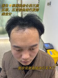 -雍禾植发全国连锁