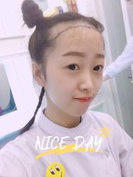 -大麦微针植发全国连锁