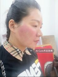 -AiCure 埃可儿·韩国医学皮肤管理