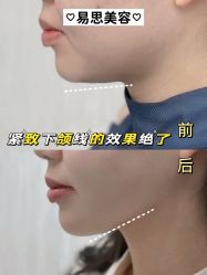 -EC BEAUTY易思美容