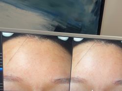 -苑苑vbeauty科技美容SPA
