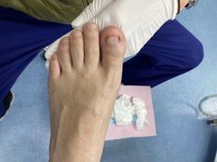 -Andrew指甲专科灰指甲·甲沟炎矫正·3D步态矫形鞋垫定制(上海法华镇路旗舰店)