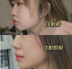 -上海漾颜医疗美容