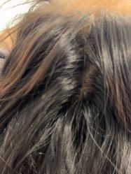 -熙朵美学植发·连锁品牌