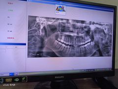 -土豆口腔(凤凰北总店)