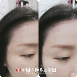点击看大图 -西施无菌半永久纹绣眉眼影唇轻增发纹发际线