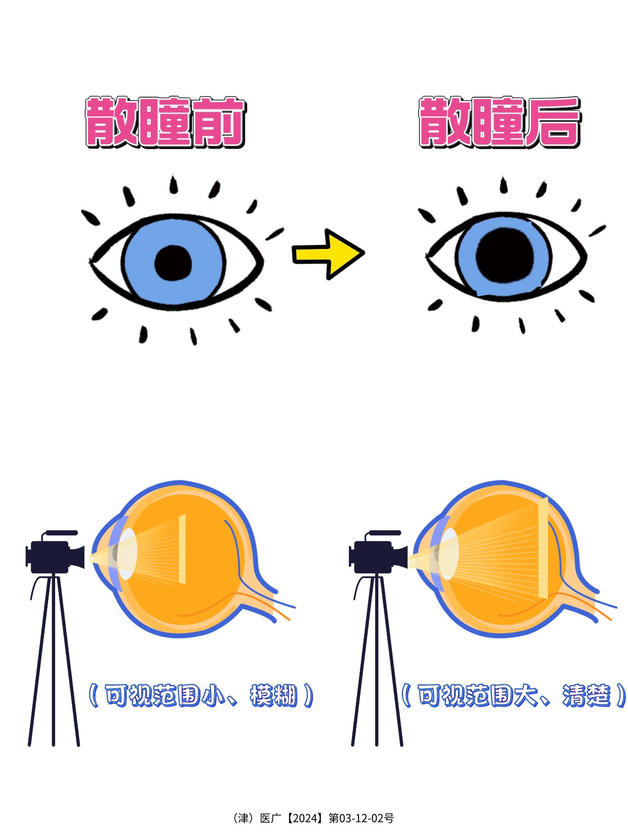 查眼底必须散瞳吗
