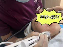 -联合丽格·张菡丽格医疗美容