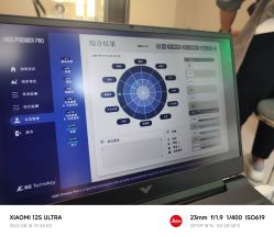 -润复丝·泽发防脱头皮管理