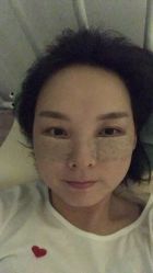 体验后-深圳广和门诊部·整形医疗美容