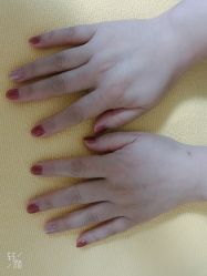-赢韵美甲美睫瑞士净斑中心