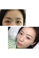 点击看大图 -MIVI半永久纹眉机器野生眉纹唇