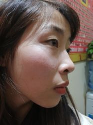 -痣缘宫