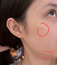 -广州美莱医疗美容医院