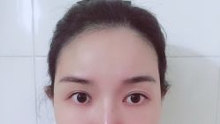 -清颜专业祛痘连锁店
