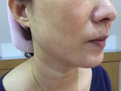 点击看大图 -天津伊美尔医疗整形美容专科医院