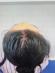 -雍禾植发全国连锁