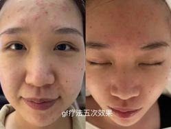 -LUNA皮相美·骨相美高级美感