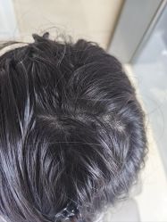 -碧莲盛·不剃发植发