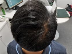 -章光101防脱养发荟