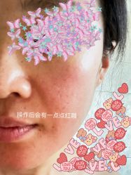 -亿美医疗美容·半岛大超炮官方授权店