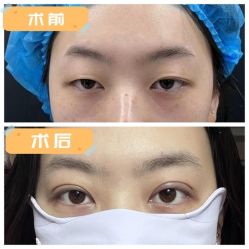 -素美医疗美容·西南眼鼻整形·修复基地