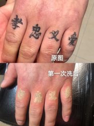 -秦好山专业洗纹身