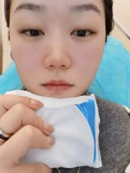 体验前-北京米扬丽格医疗美容·联合丽格鼻整形中心