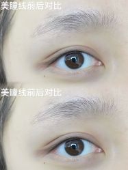 -张小野·专业半永久纹眉