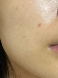 体验后-深圳美莱医疗美容医院