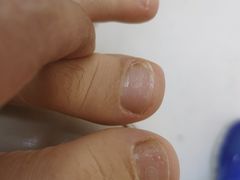 -新甲连锁灰指甲·甲沟炎·鸡眼(黑龙江路店)