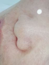 -蕾特恩专业祛痘·皮肤管理