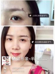 iphone_upload_pic-MIVI·纹眉半永久野生眉