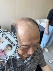 -唐风采假发补发定制