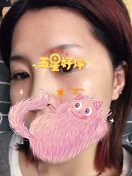 体验后-JUVA郑州欧华医疗美容医院