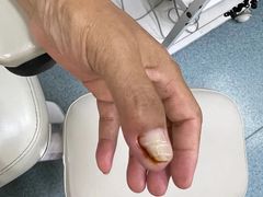 -新甲连锁灰指甲·甲沟炎·鸡眼(黑龙江路店)