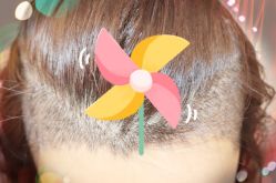 -大麦微针植发全国连锁