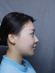 -深圳艺星医疗美容医院