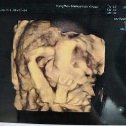 -杭州贝瑞斯美华妇儿医院·早孕·产检·儿科