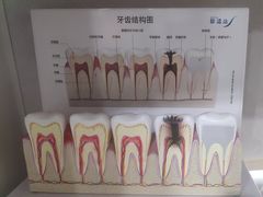 -上海仁爱医院口腔科 · 种植