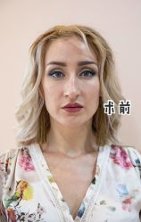 -广州美莱医疗美容医院