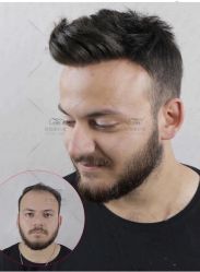 -发饰美男士增发补发假发定制店