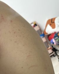 -莱可美科技美肤