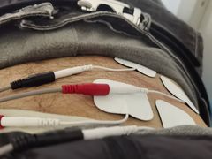 -无锡市第二人民医院(南院)